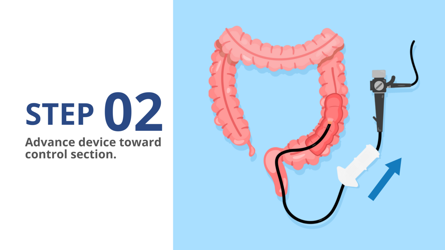 AIR ASSIST 3 STEP PROCESS.pptx (1)